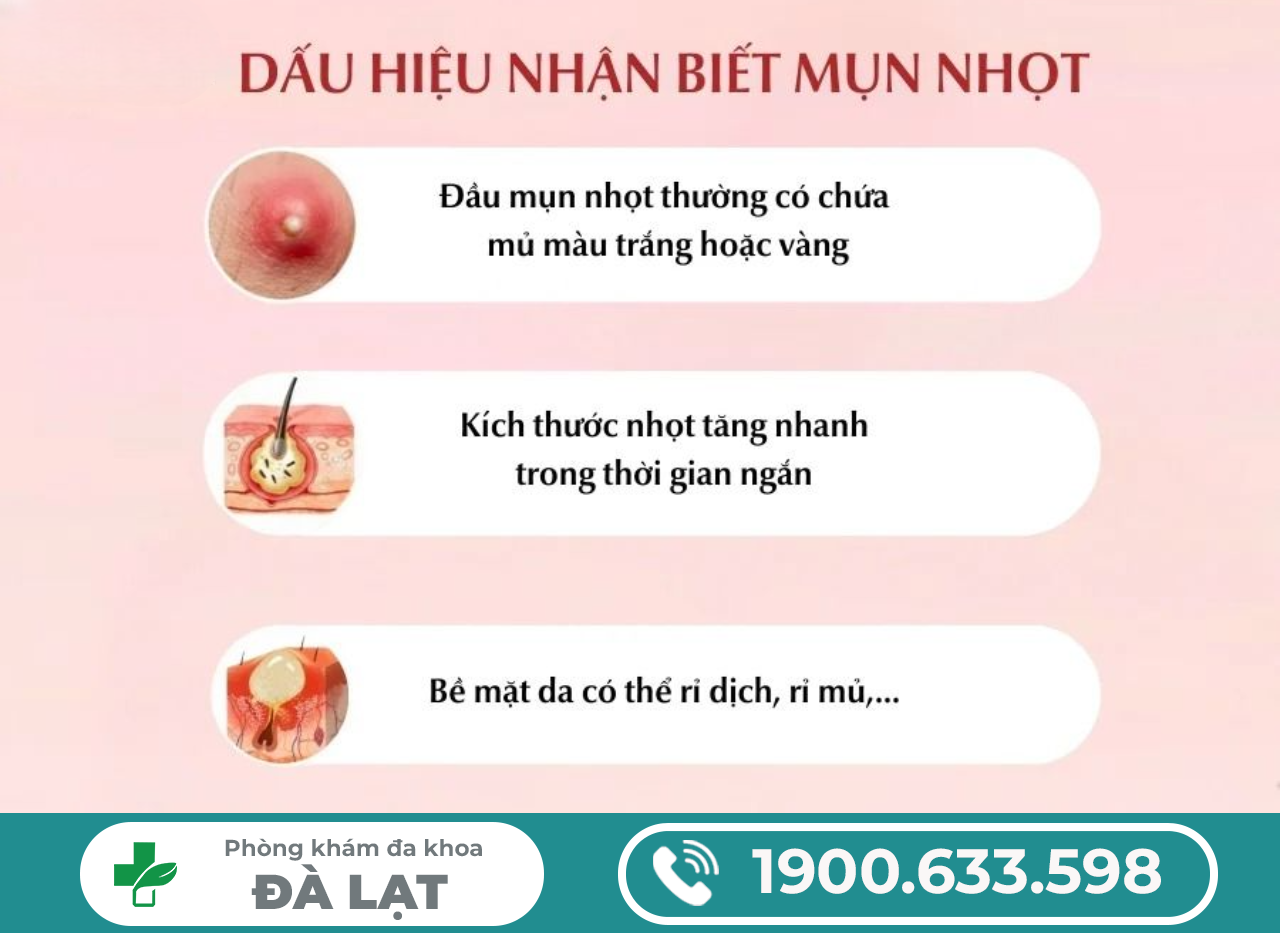 Hình ảnh minh họa